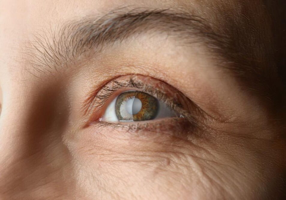 Detailed view of eye and brow